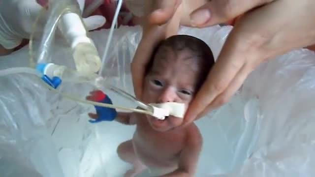 Meu bebe prematuro