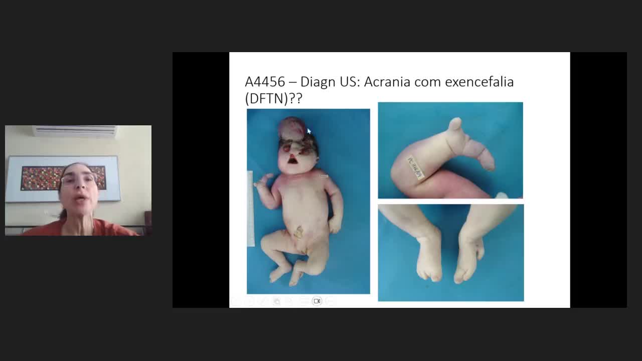SIG Genética Médica e Doenças Raras*