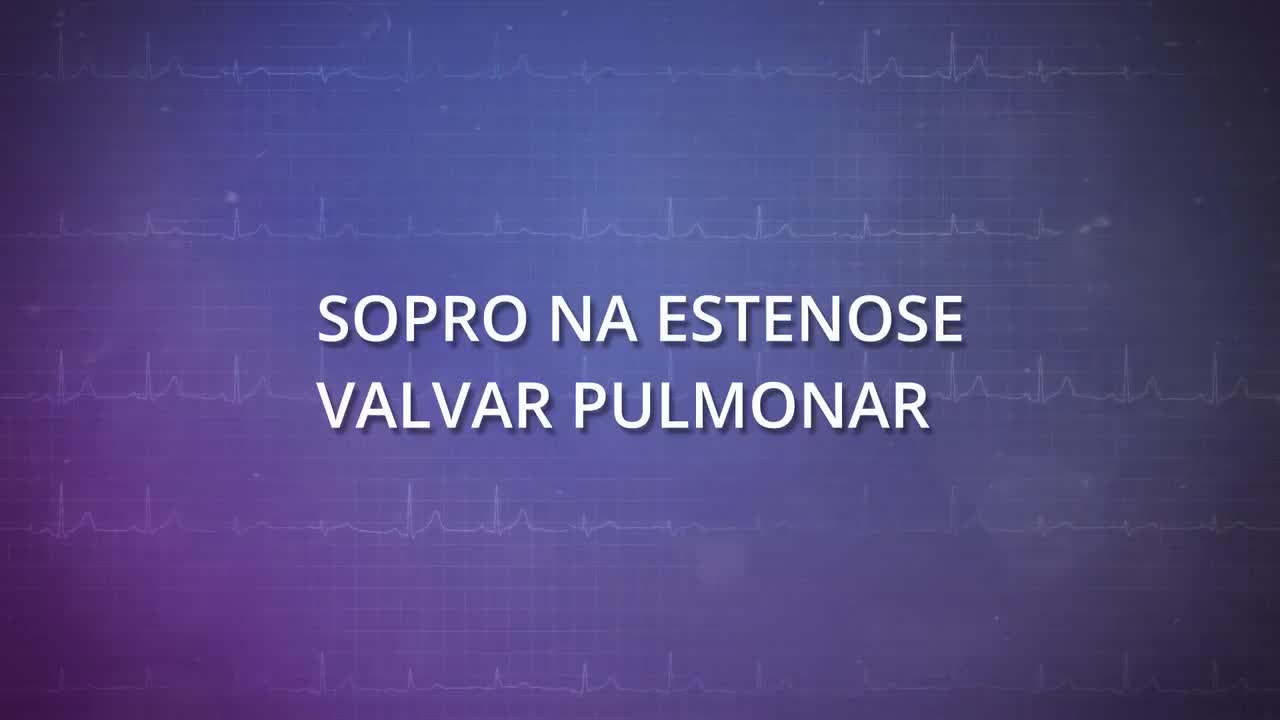 Sopro na estenose valvar pulmonar